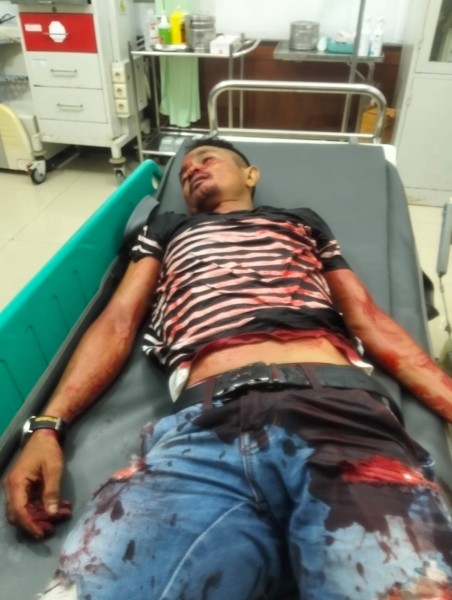 Mass Hampir Bakar See You, Seorang Polisi di Rohil Tewas Ditusuk Penjaga Tempat Hiburan