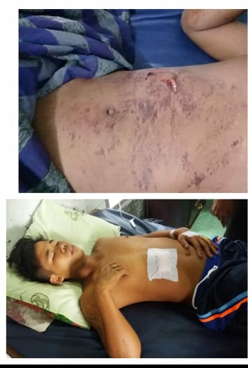 Gara -Gara Minum Tuak, Bejo Warga Rohil Tewas Ditusuk Pisau Oleh Kawan Peminumnya