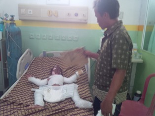 Nsibnya Miris,  Bocah Umur 3 Tahun di Rohil Terbakar Nsibnya Miris,  Bocah Umur 3 Tahun di Rohil Terbakar