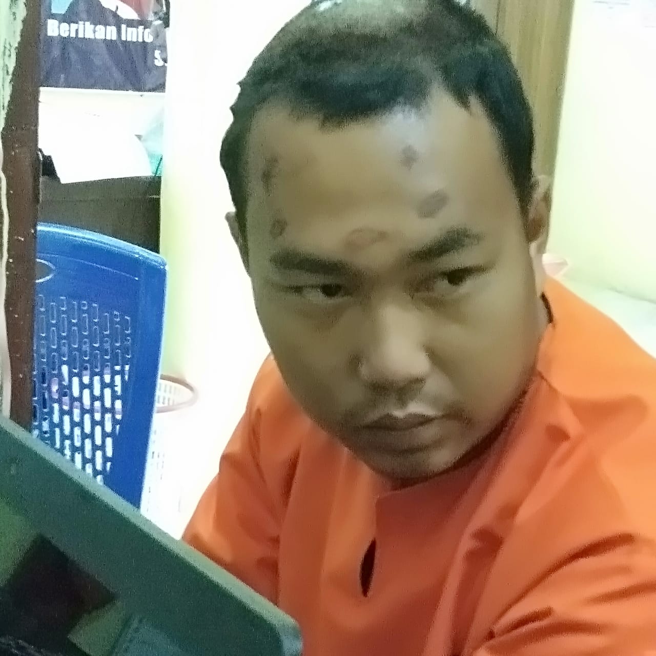Klien Luka -Luka, Kalna CS Akan Laporkan Oknum Pelaku Kekerasan