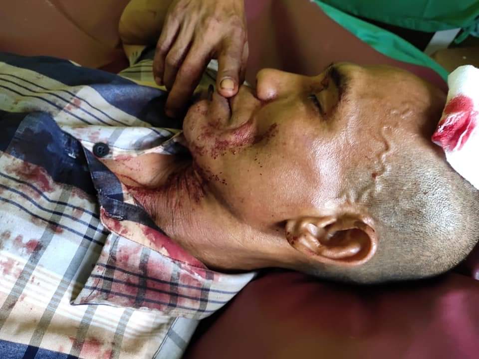 Arogan, Security PT SS Hantam Kepala Warga Hingga Koyak