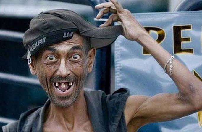 Orang Gila Nyoblos, KPU Minta Dokter Pendamping