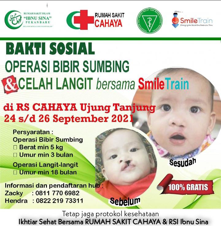 RS Cahaya Ujung Tanjung Bersama RS Ibu Sina Gelar Oprasi Bibir Sumbing Gratis RS Cahaya Ujung Tanjung Bersama RS Ibu Sina Gelar Oprasi Bibir Sumbing Gratis